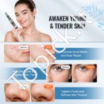 Elektrinis Dermapen mikroadatinis rašiklis (6 greičiai) su 6 adatom 0-2,5 mm - Image 6